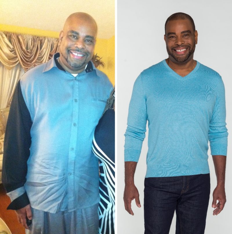 obesity weight loss success story